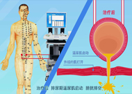 人和醫(yī)院 尿潴留、尿失禁動(dòng)畫